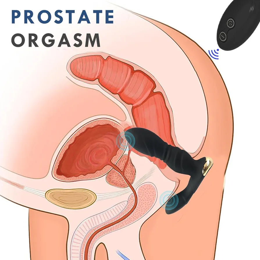 MASAJEADOR DE PRÓSTATA CON DOBLE MOTOR, MOVIMIENTO TELESCÓPICO Y CONTROL REMOTO